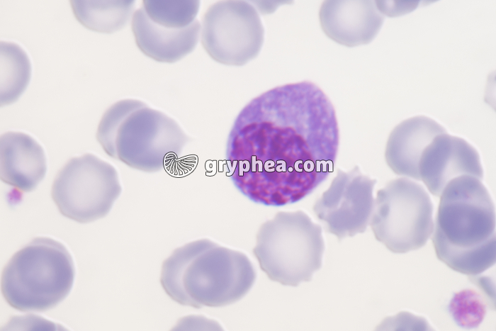 Plasmocyte x800 - gryphea.org